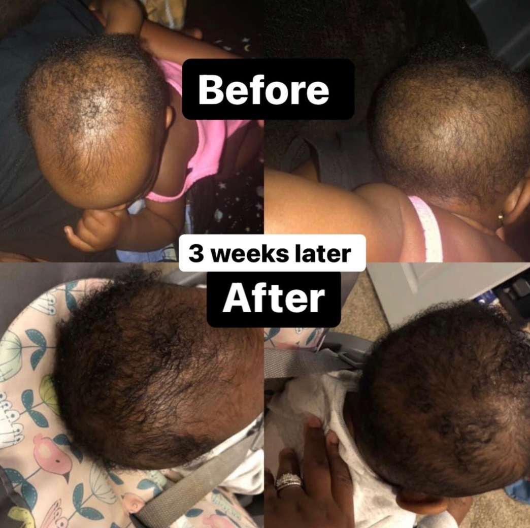 Léaura Hair Growth Serum