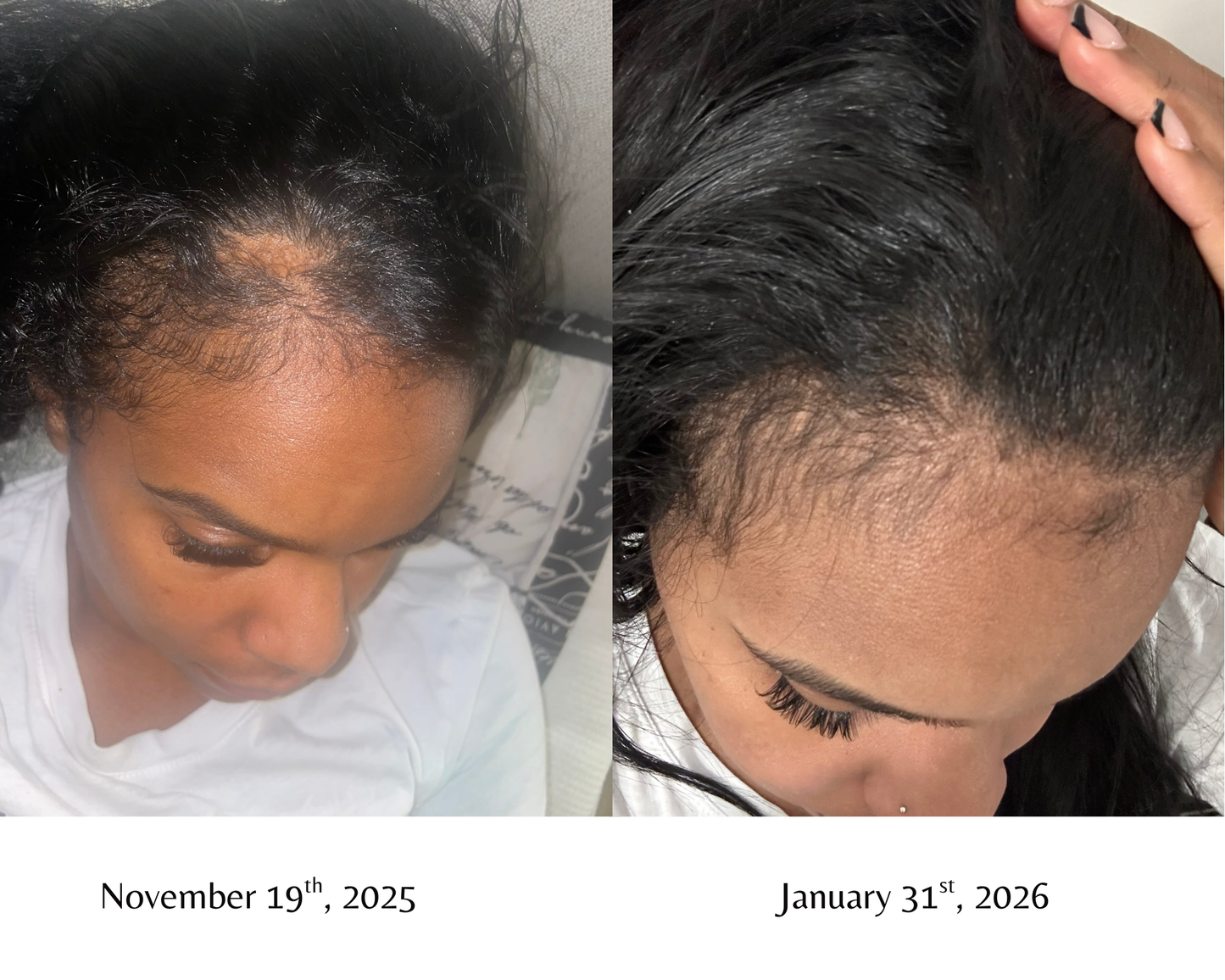 Léaura Hair Growth Serum
