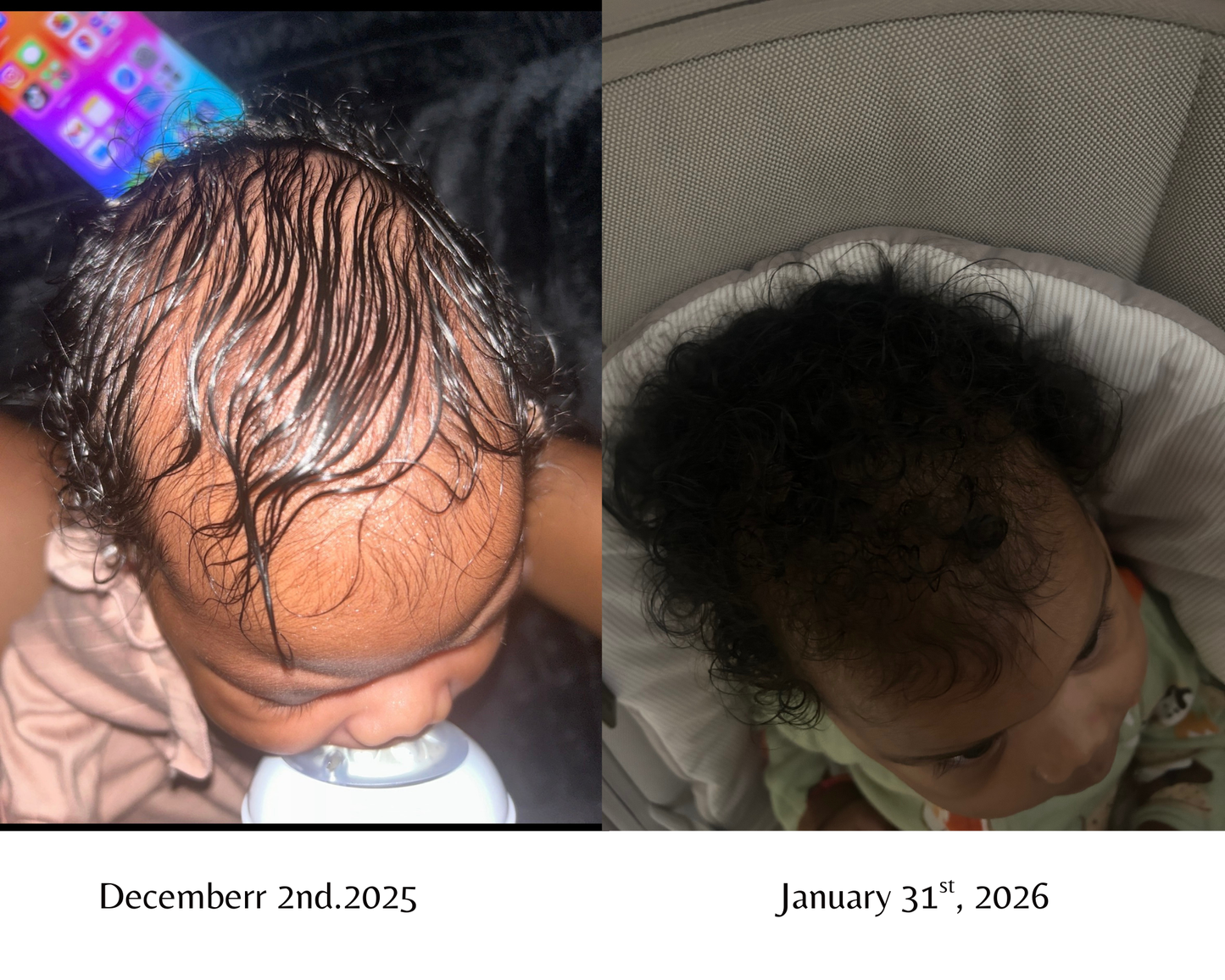 Léaura Hair Growth Serum