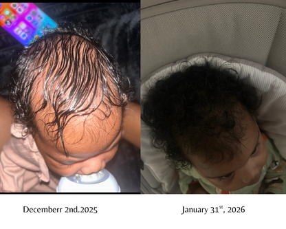 Léaura Hair Growth Serum